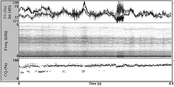 Fricativo sonoro /Z/: modificações vocais 917 Figura 1 EX PRÉ-TÉCNICA (pouca definição de harmônicos, presença de ruído em todo o espectro, substituição de harmônicos por ruído nas freqüências altas)
