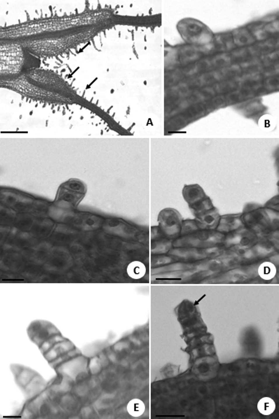 Diversidade e desenvolvimento dos tricomas glandulares de Lomatozona artemissifolia Baker... 241 Figs. 4A-F.