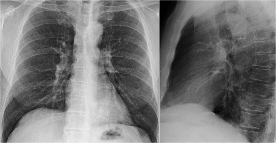 ABORDAGEM SISTEMÁTICA DA RADIOGRAFIA DE TÓRAX Áreas de revisão