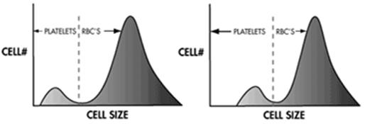 Esferotização Processo isovolumétrico Elimina os erros de deformação e de orientação Esferotização Cell-DynRuby/3200 MCV Field Guidelinev 1.0 Histograma de plaquetas.