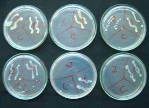 Figura 2: Eficiência de vários produtos na desinfeção das pinças contaminadas com Escherichia coli e com Bacillus subtilis (C=traço com a pinça esterilizada, 1=