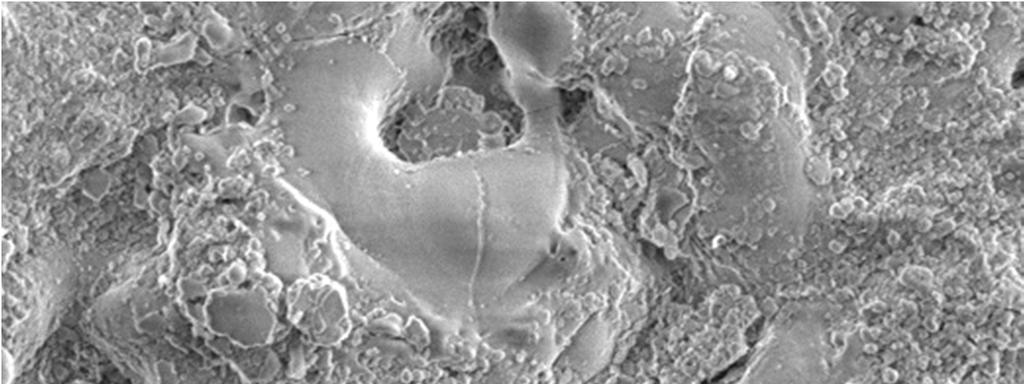 Micrografias dos revestimentos obtidos com resíduo de caulim por PEO em substrato de liga de alumínio 5052 na concentração de 5g/L (A) tempo de deposição de 5min, (B) tempo de