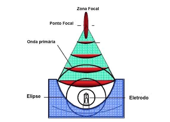 11 Figura 1 Esquema ilustrando um litotridor eletrohidráulico [27] Os litotridores piezoelétricos geram ondas de energia a