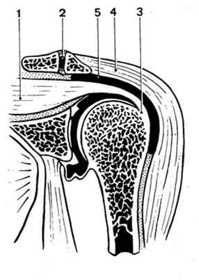 Articulação Subacromial ou Subdeltóidea Articulação Subacromial ou Supra- Umeral
