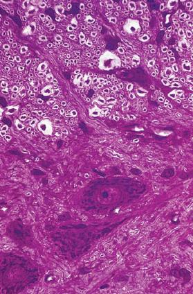 Substância branca: prolongamentos de neurônios (mielina) e células da glia Substância