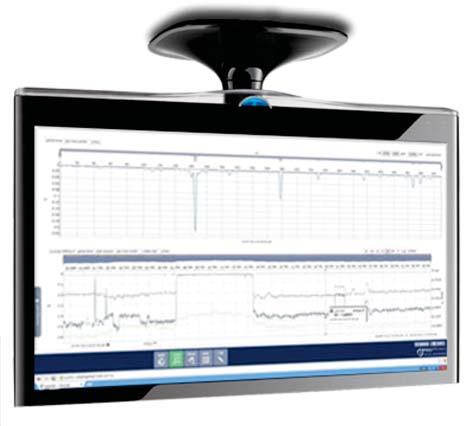 Monitoramento contínuo da saúde da máquina Interface simples e de fácil utilização Análises temporais e espectros de freqüência Diversos recursos de alarme e notificações Ferramentas de fácil análise