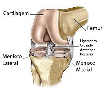 Rupturas do menisco As lesões meniscais estão presente em quase todas as idades, sendo as mais comuns no joelho. Atletas, que praticam esportes de contato, têm mais chances de romper o menisco.