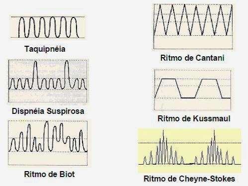 16 8. Temperatura TºC: Um importante sinal vital, que pode ser medido em regiões axilar, oral, timpânica, dentre outros.