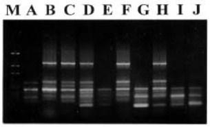 Marcadores Moleculares de DNA Muitos tipos diferentes: