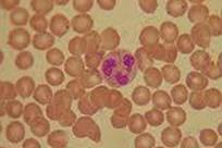 000/ml de sangue Gênese dos glóbulos brancos GLÓBULOS BRANCOS GRANULÓCITOS Neutrófilos Eosinófilos Basófilos