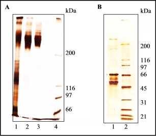 Resultados 33 Figura 10. SDS-PAGE (5 % e gradiente 3-15 %) das frações obtidas do processo de purificação do fibrinogênio de B. jararaca. (A) SDS-PAGE em condições não reduzidas: (1) plasma de B.