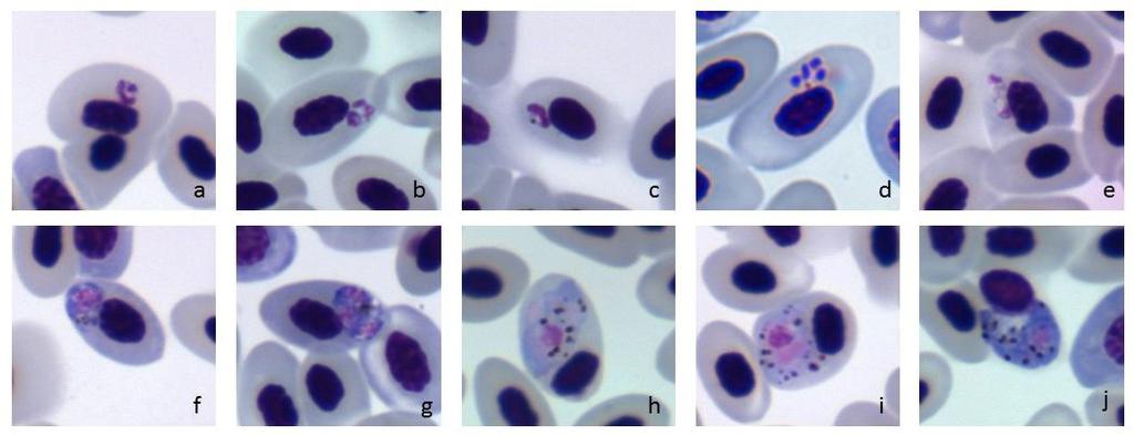 62 (Figura 15, h-j), bem como merontes imaturos com muito citoplasma, também capazes de deslocar o núcleo do eritrócito infectado (Figura 15, f-g).