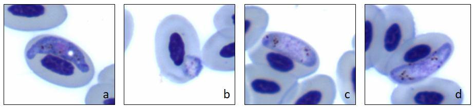 68 foi possível verificar a presença de gametócitos jovens arredondados (Figura 21, b), além de gametócitos alongados (Figura 21, a, c-d).