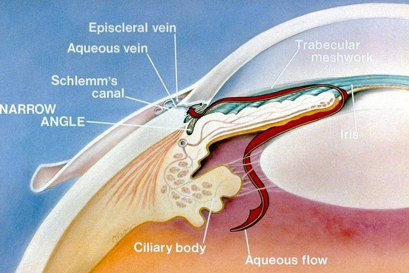 Glaucmas primáris Prfessra Núbia O DM é a primeira causa de cegueira irreversível n mund. O glaucma é a segunda. Das causas reversíveis de cegueira, a catarata é a principal.