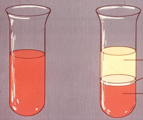 CENTRIFUGAÇÃO (Líquido-Líquido) A centrifugação consiste na separação de duas fases por acção de uma força centrífuga a que se sujeita a mistura, quando entra