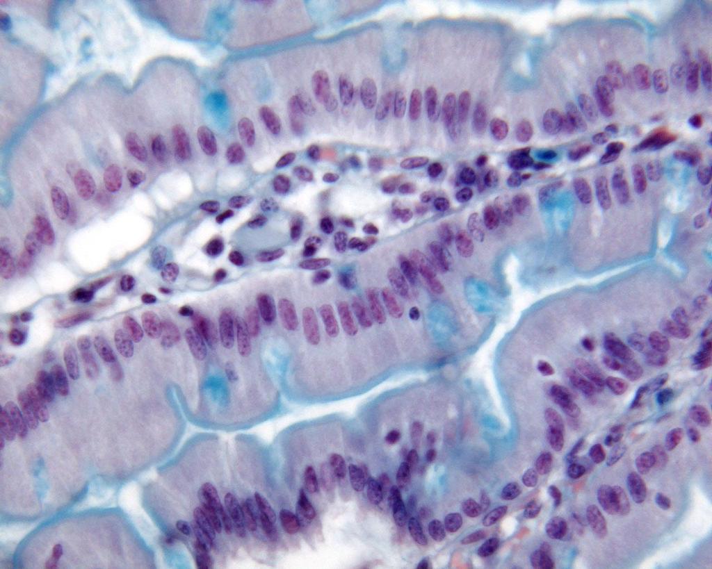 GLÂNDULAS EXÓCRINAS Células secretoras isoladas Célula Caliciforme
