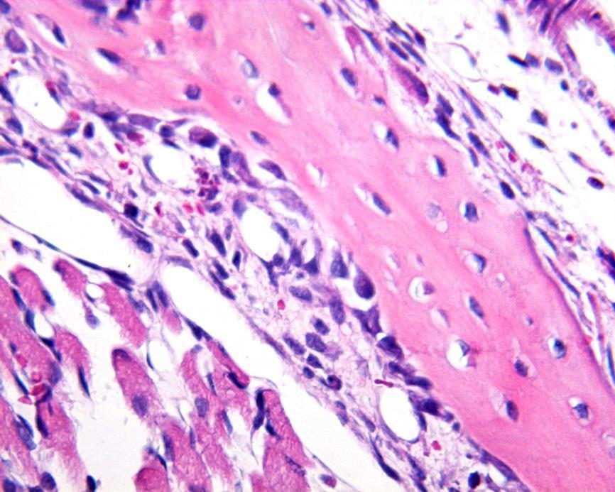 Intramembranosa Vaso sangüíneo Osteócitos Osteoblasto