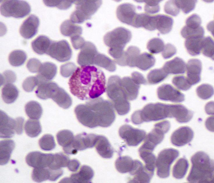 Basófilo Neutrófilos Basófilos: são os glóbulos menos numerosos dentre os