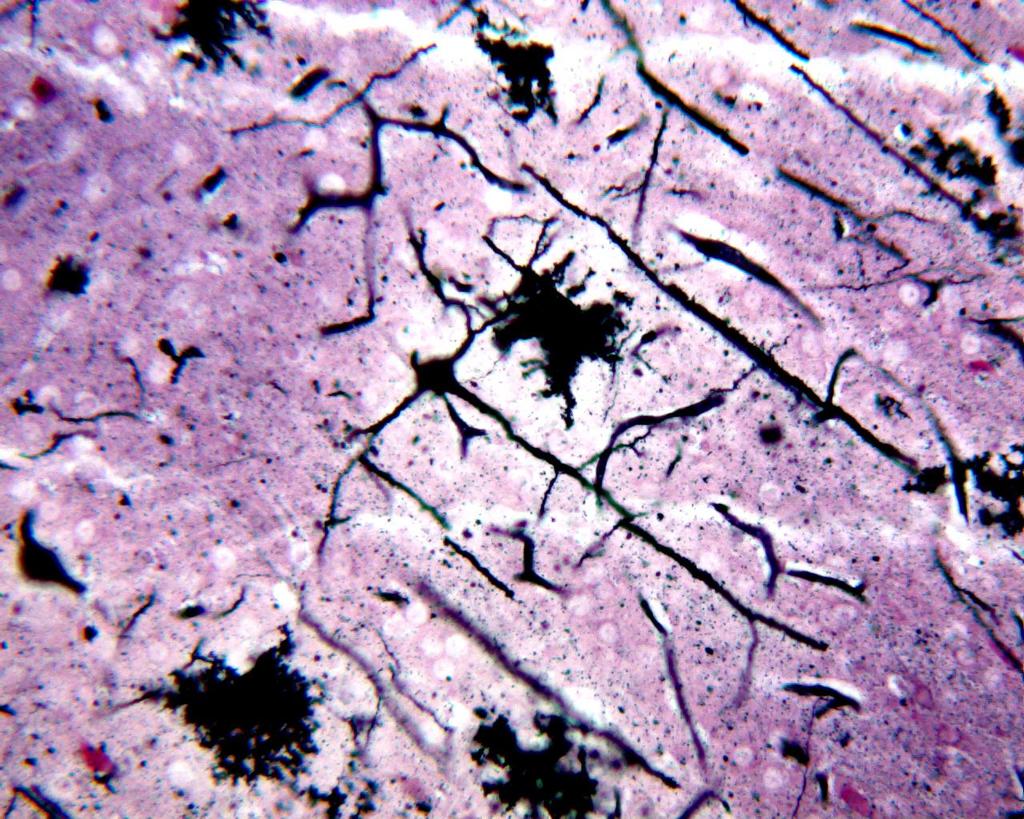 Tecido Nervoso Fibras nervosas Corpo celular Neurônio Astrócito