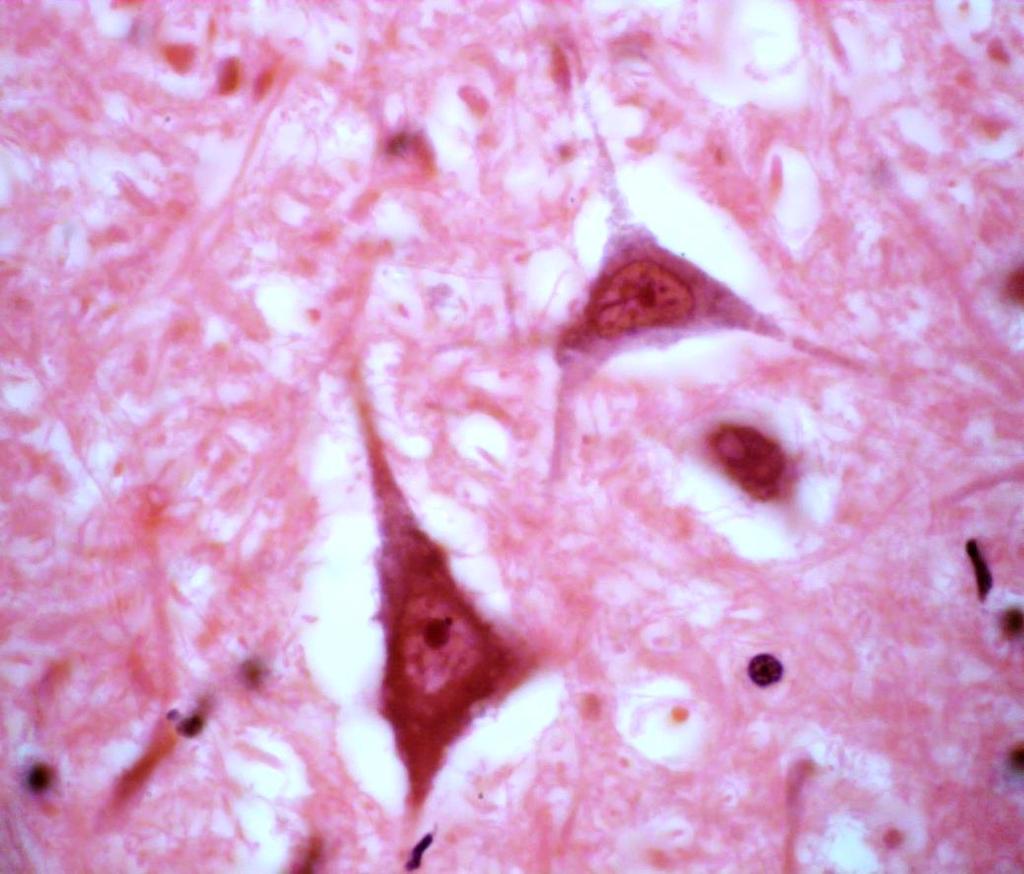 Celular Neurônios Corpo Celular Nucléolo
