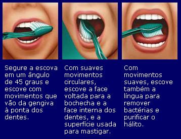 Desenho demonstrativo dos movimentos da escova durante a escovação. Existe prevenção contra cáries?