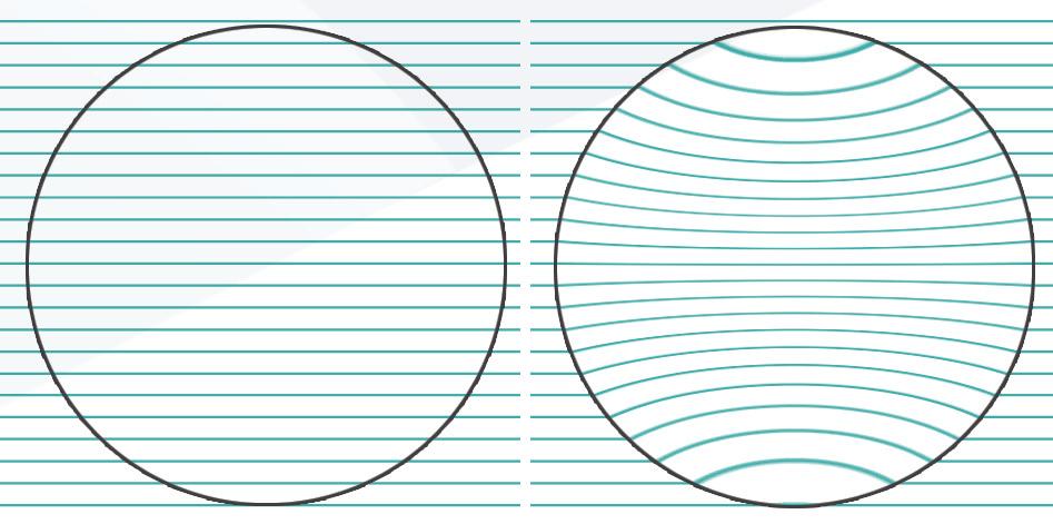 olho humano, proporcionando maior conforto, melhor qualidade na visão intermediária, visão periférica nítida e lentes com menor peso e espessura.