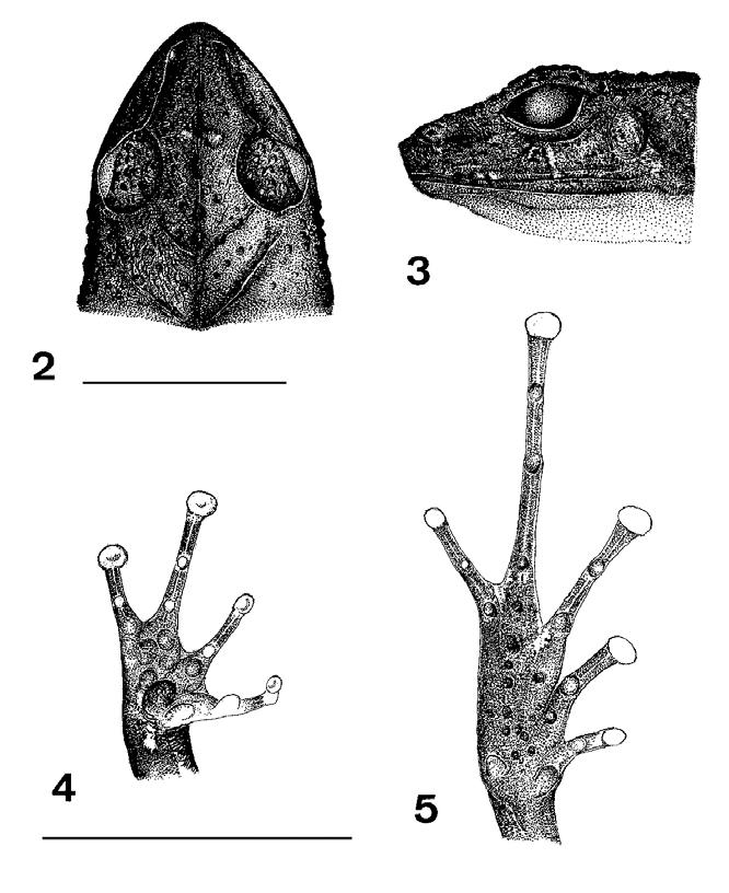 4 REDESCRIÇÃO DE ELEUTHERODACTYLUS BOLBODACTYLUS (A.LUTZ, 1925)... 5mm 5mm Eleutherodactylus bolbodactylus (MNRJ 24133): fig.2 vista dorsal da cabeça; fig.3 vista lateral da cabeça; fig.