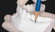 Avaliação longitudinal de arcadas dentárias individualizadas com o método Borda WALA Métodos Para a demarcação dos eixos, pontos e bordas de referência, e obtenção das dimensões nos modelos de gesso,