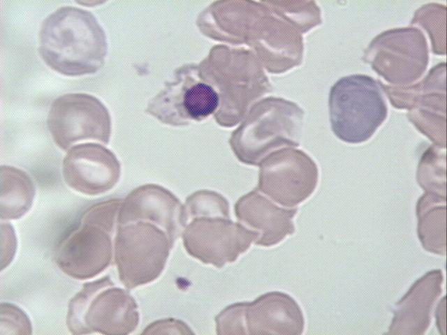 Pró-eritroblastos