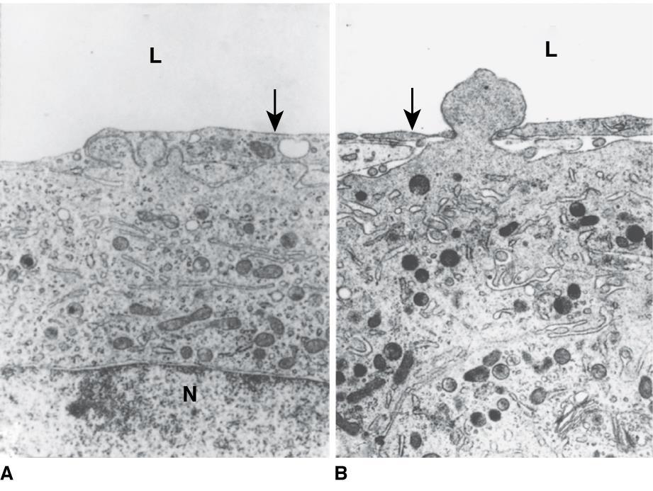 Transmission electron micrograph of mouse femoral marrow. A. The lumen (L) of a marrow sinus is indicated. The arrow points to the thin endothelial cytoplasmic lining of the sinus.