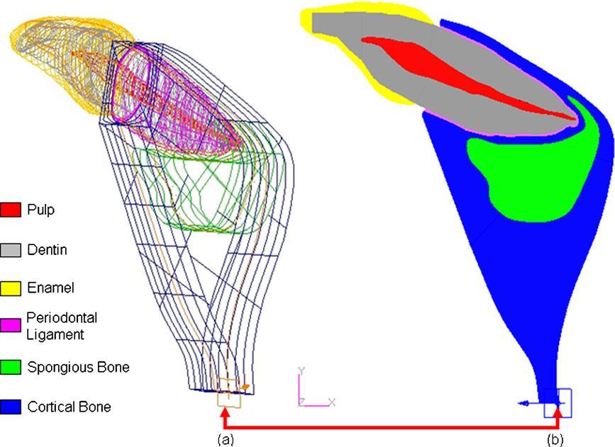 2D and 3D finite element analysis of central incisor