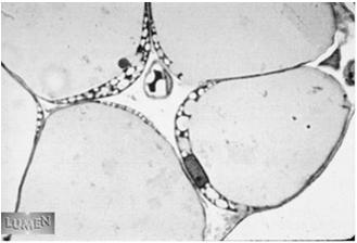 CÉLULAS Células Adiposas: Armazenam gorduras Origem: fibroblastos célula mesenquimal Características histológicas G