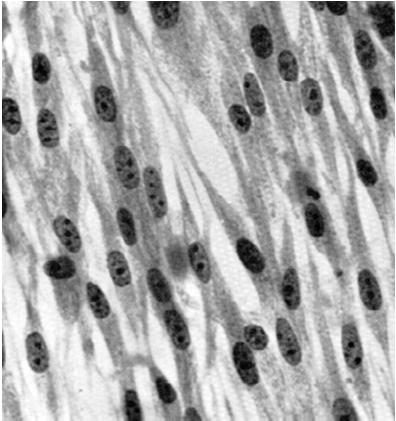 CÉLULAS: FIBROBLASTOS Microscospia Óptica Células fusiformes com