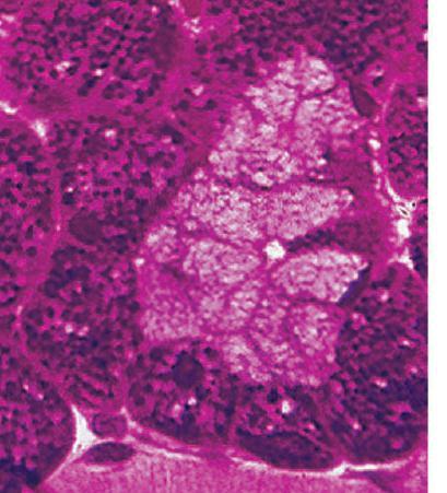 Glândula mucosa: secreção rica em mucígenos, que em contato com a água do lúmen