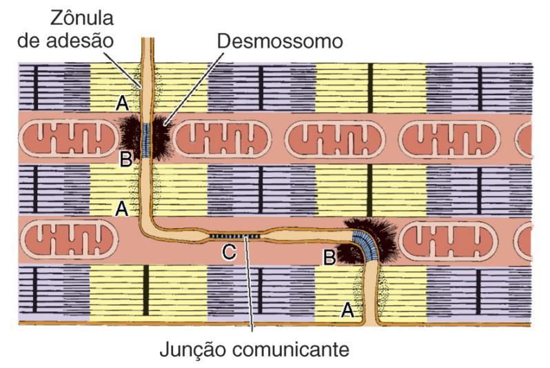 Estriado Cardíaco