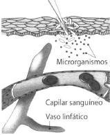 7. A figura 3 ilustra um local onde tem início uma reação inflamatória. 7.1 Identifique o fator que desencadeia a reação inflamatória. 7.2 Refira duas alterações visíveis que surgirão no local representado na figura e explique as razões da sua ocorrência.