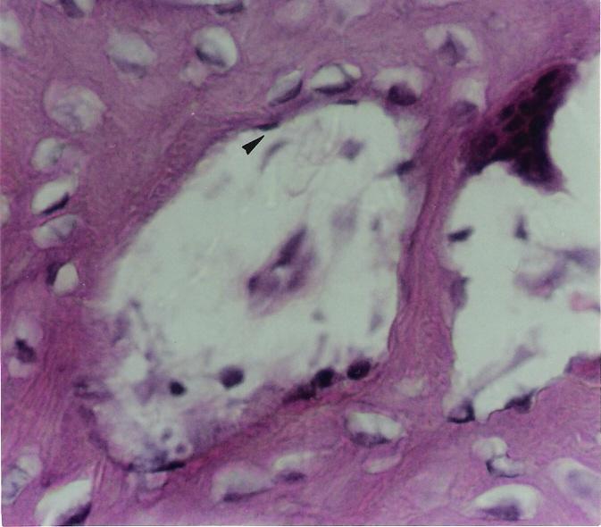 ATLAS DIGITAL DE BIOLOGIA CELULAR E TECIDUAL As células osteoprogenitoras e os osteoblastos dipostos na superfície da matriz óssea compõem o endósteo, importante para a manutenção e o reparo do