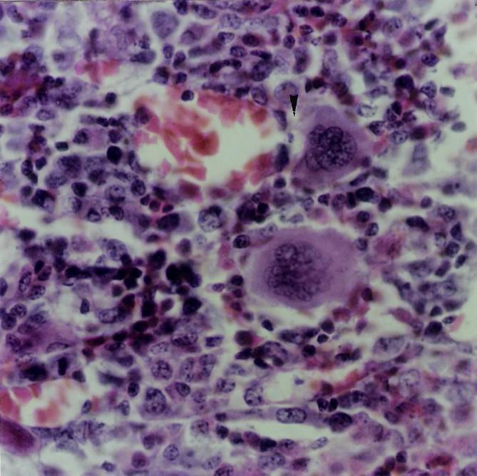 TATIANA MONTANARI Figura 3.31 - No tecido mieloide, entre as diversas células hematopoéticas, destacam-se, pelo grande tamanho, dois megacariócitos.