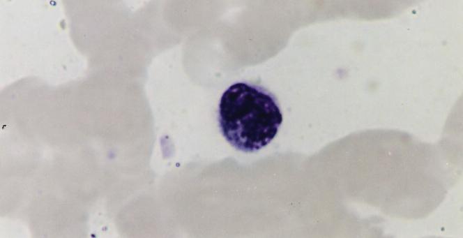 Os grânulos azurófilos e eosinófilos são lisossomos. Os eosinófilos limitam o processo alérgico, fagocitam o complexo antígeno-anticorpo e destroem parasitas.