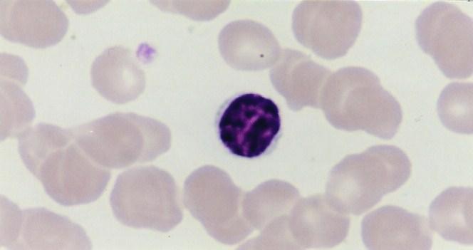 resposta imunológica (células T citotóxicas, auxiliares ou supressoras, respectivamente). Figura 3.