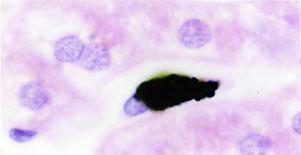 TATIANA MONTANARI Figura 3.4 - Macrófago do fígado (célula de Kupffer) que fagocitou partículas de nanquim. HE. Objetiva de 100x (1.373x).