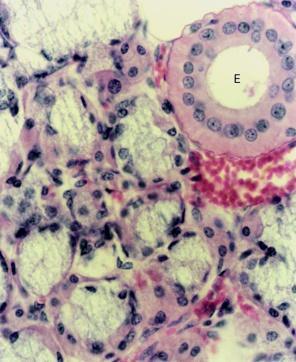 restante da glicosilação e o empacotamento das glicoproteínas em vesículas, no Golgi; os grânulos de secreção comprimem o núcleo na base da célula; o citoplasma aparece palidamente corado e