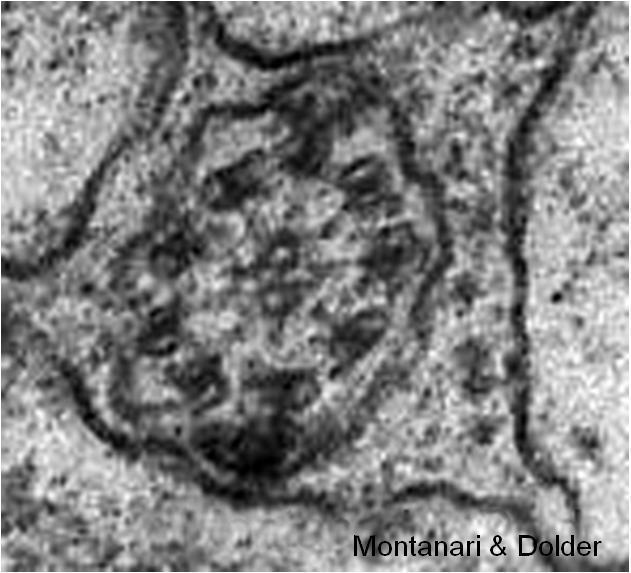11 - Corte transversal do axonema presente no flagelo do espermatozoide. 187.500x.