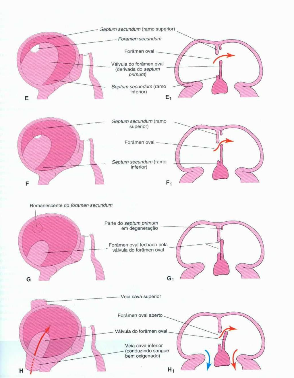 Foramen oval Foramen secundum A cessão da comunição atrial é anatomicamente possível devido à POSIÇÃO