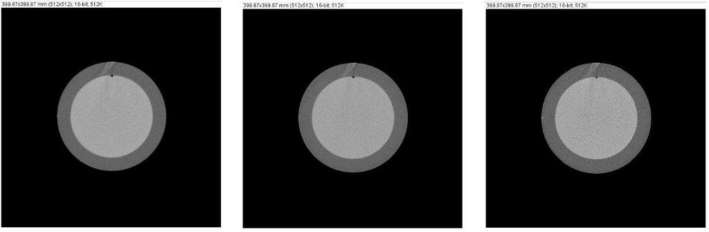 76 Processamento automático de imagens DICOM para otimização de doses em exames de Tomografia Computorizada pela menor uniformidade da ROI utilizada.