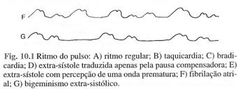 carótida, femoral.