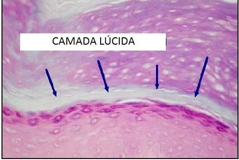 Estrato Lúcido Localizada apenas em pele