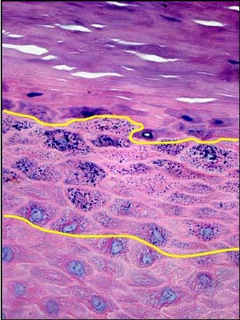 Estrato granuloso Grânulos de querato-hialina: Matriz interfibrilar( Filagrina) Banda marginal(revestimento interno