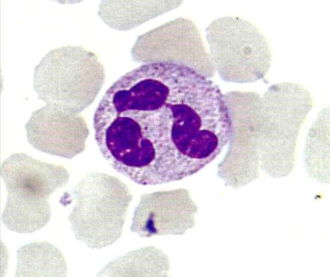 Neutrófilos (Leucócitos Polimorfonucleares) Leucócitos mais abundantes no sangue; Medeiam a fase