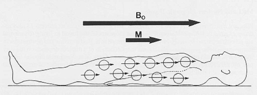 Figura 3: uma vez estando o paciente no campo magnético, seus núcleos ficam com a mesma orientação e geram um campo resultante pela soma vetorial de seus momentos magnéticos.